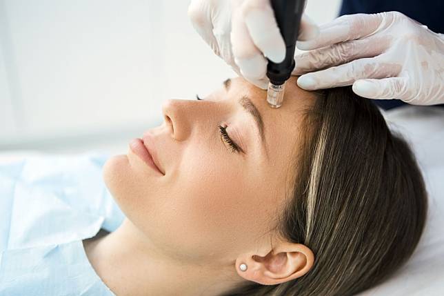 Microneedling is also known as collagen induction therapy (Photo: Getty Images)