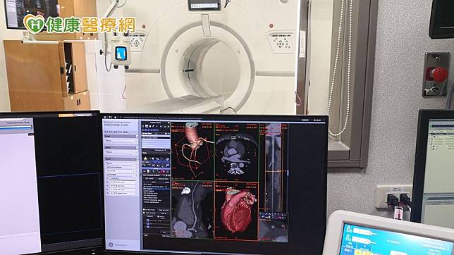 冠狀動脈疾病(CAD)是因心血管會隨年齡老化和一些危險因子，使冠狀動脈內壁脂肪沈積形成粥狀硬化、血管徑逐漸狹窄，導致供應心臟的血液、養分和氧氣不足造成心肌缺血或梗塞，冠狀動脈直徑狹窄超過50%時，即可稱為阻塞性CAD。