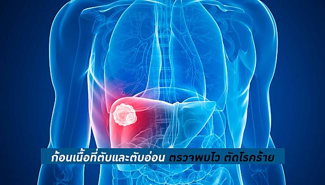 ความรู้เกี่ยวกับโรคตับ ตับอ่อน – อาการของโรค ปัจจัยเสี่ยง การรักษาผ่าตัด