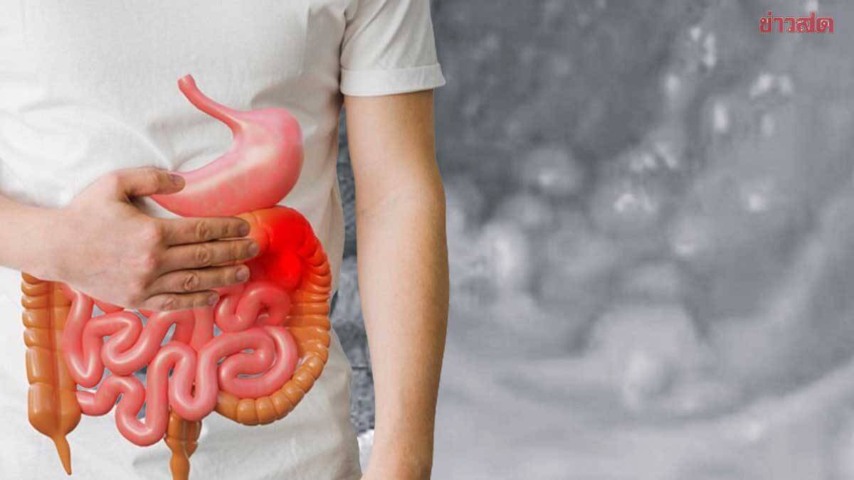 Doctor Chedi Warns: Careful with Fiber Intake - News Directory 3