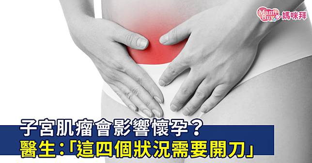 子宮肌瘤會影響懷孕？醫生：「發生這四個狀況需要開刀」