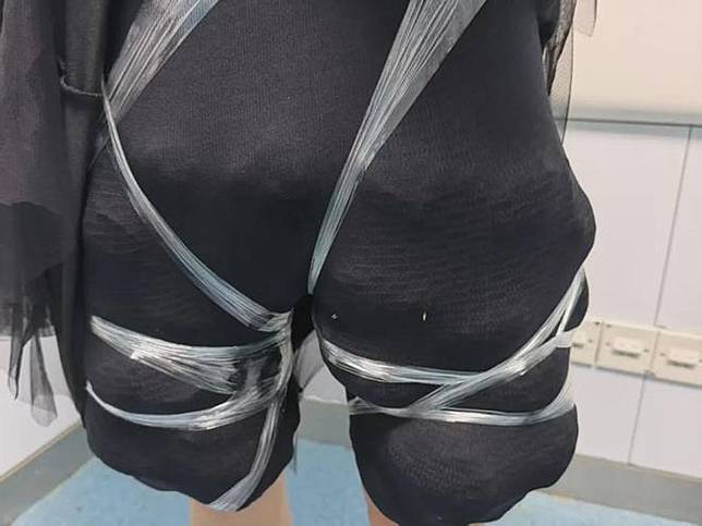 涉案女子雙腿密密麻麻全是活體陸龜，令人看傻眼。（翻攝自極目新聞）