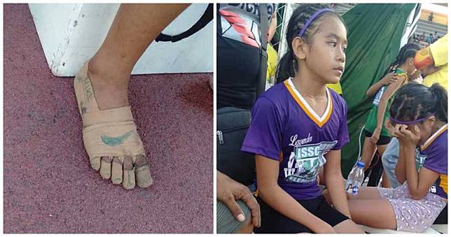 勵志又心酸！11歲女參賽奪三金　「繃帶跑鞋」曝光