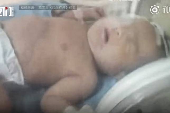 The unidentified baby was found by a couple picking mushrooms on a hillside. Photo: Weibo