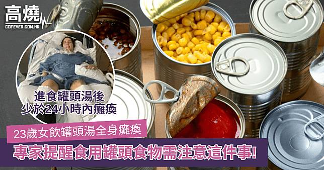 【罐頭】23歲女飲罐頭湯全身癱瘓 專家提醒食用罐頭食物需注意這件事!