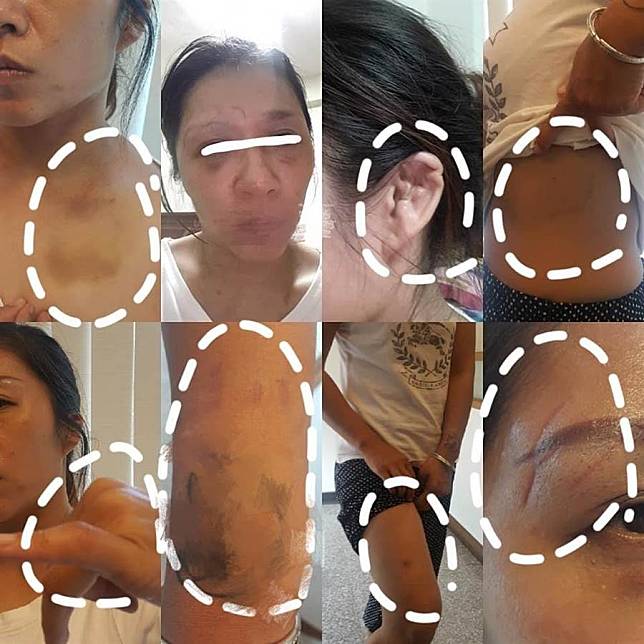 台南再傳家暴虐童案件