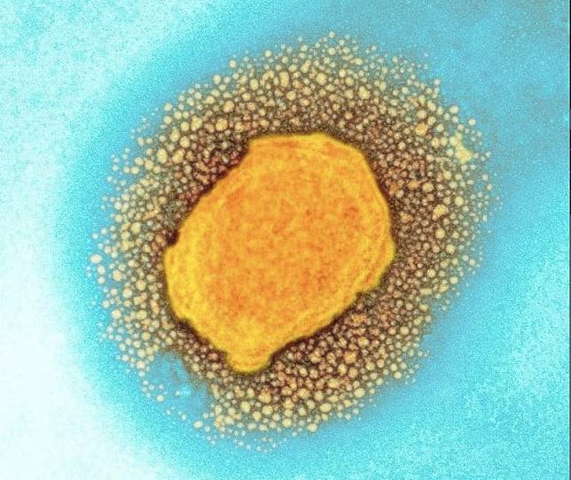 :猴痘病毒的彩色透射電子顯微照片。圖片來源：英國衛生安全局/科學圖片庫