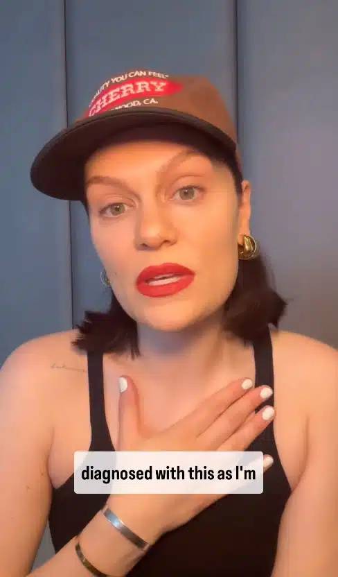 เจสซี เจ นักร้องดังชาวอังกฤษเป็นโรคมะเร็งเต้านม