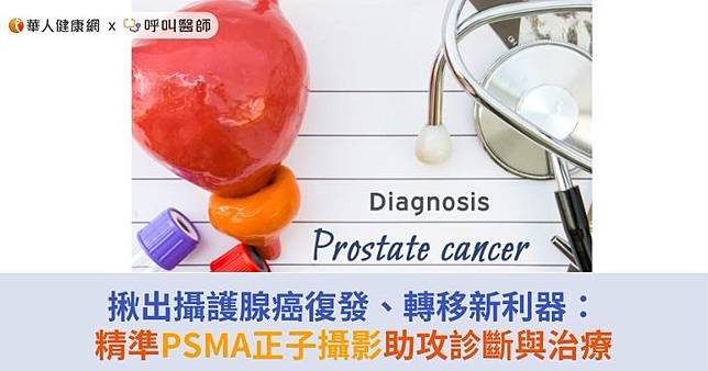 揪出攝護腺癌復發、轉移新利器：精準PSMA正子攝影助攻診斷與治療