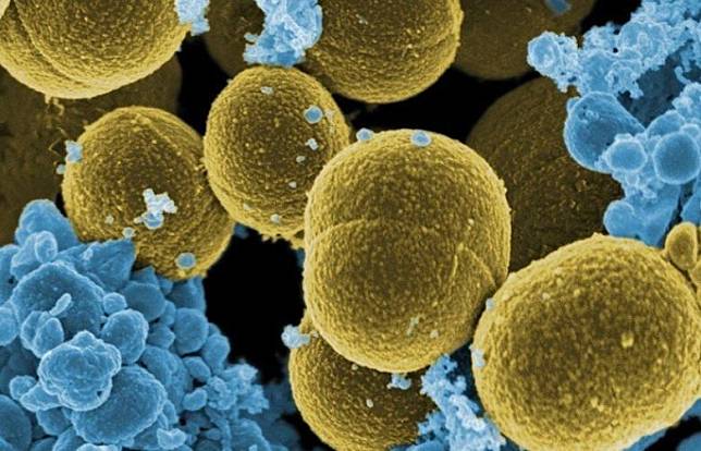 超級細菌增加 研究：2019年逾120萬人死於抗藥性感染（示意圖／Foter）