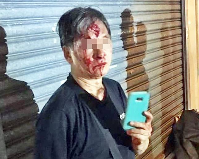 遇襲男子血流披臉。fb「香港人連儂牆」Machi Ho‎圖片