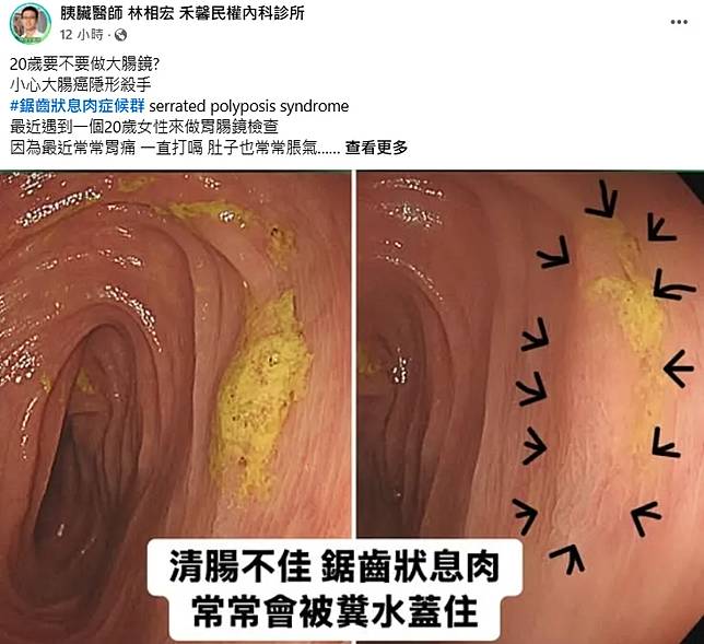 （圖／翻攝自胰臟醫師 林相宏 禾馨民權內科診所）