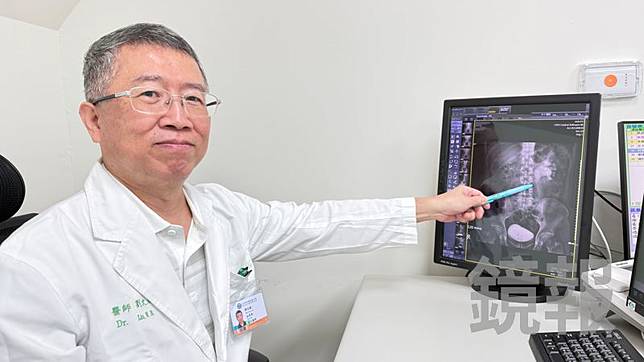 泌尿科醫師劉文斌提醒夏天流汗多要多補充水分，避免以手搖飲取代以免增加結石風險。亞大附醫提供
