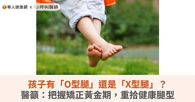 孩子有「O型腿」還是「X型腿」？醫籲：把握矯正黃金期，重拾健康腿型