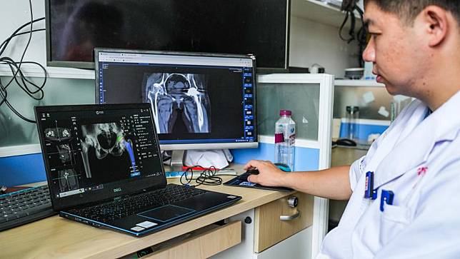 A doctor makes a surgical treatment planning using AI software before a hip joint replacement surgery at Guizhou Provincial People's Hospital in Guiyang, capital of southwest China's Guizhou Province, May 25, 2023. (Xinhua/Tao Liang)