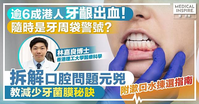 逾6成港人牙齦出血 隨時是牙周袋警號？專家拆解口腔問題元兇 教減少牙菌膜秘訣