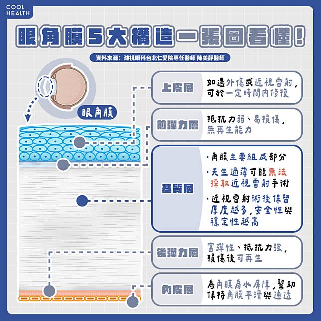 近視雷射不是誰都能做？ 眼部「1構造」太薄恐被醫師打槍