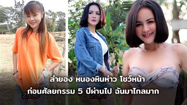 เอาผัวไปเทิร์น! ลำยอง หนองหินห่าว โชว์หน้าก่อนศัลยกรรม 5 ปีผ่านไป ฉันมาไกลมาก