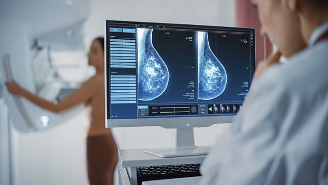乳房X光攝影檢查