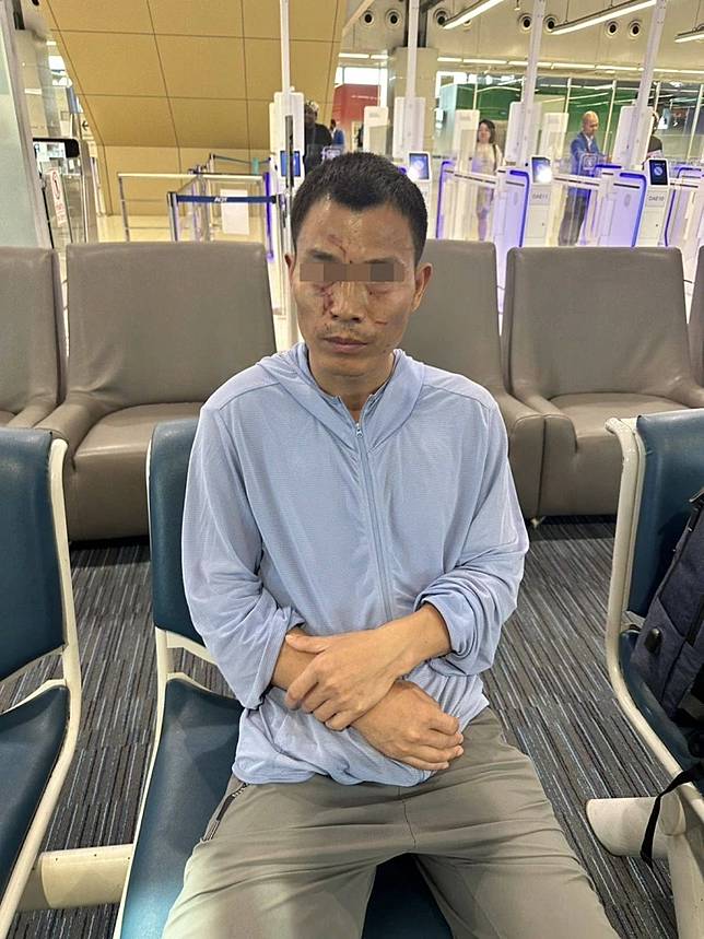 ผลผ่าร่าง มีนา สาวสองเหยื่อชายจีน ความจริงเผยแล้ว ปอดที่หายไป