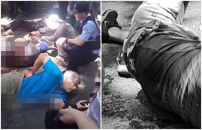 4名美國康奈爾學院教師10日在中國吉林北山公園遭遇襲擊。圖片已經馬賽克、變色處理。(圖翻攝自李老師不是你老師X平台)