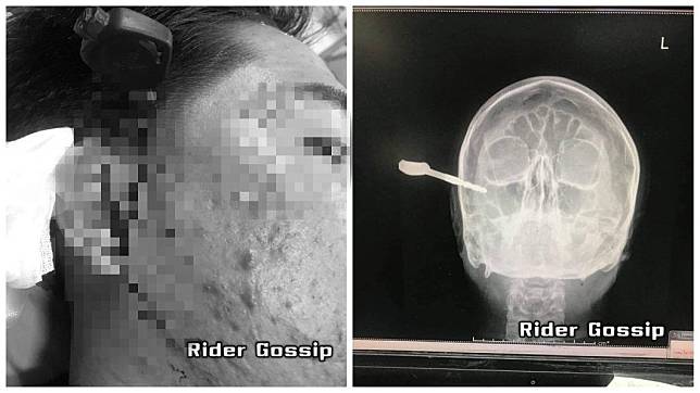 一起行車糾紛，竟讓機車騎士拔鑰匙朝對方腦袋插進去。(圖／翻攝自臉書粉絲專頁「Rider Gossip」)