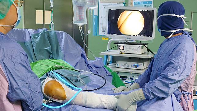 大林慈濟醫院「軟骨再生手術」 為膝關節退化帶來新曙光。