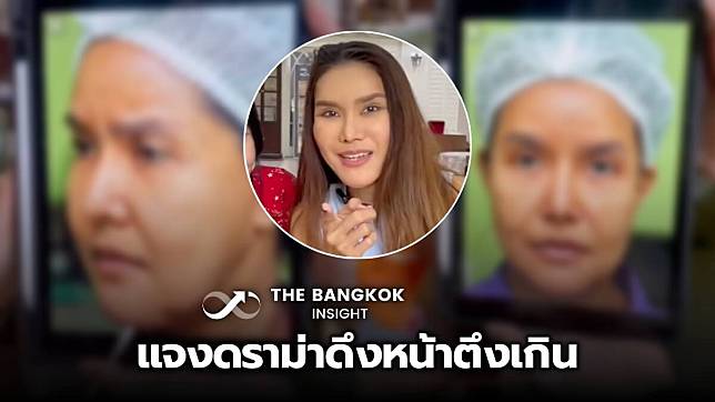 เคลียร์ดราม่า ต้อม รัชนีกร เผยสภาพหน้าจริง หน้าใหม่ 14 วัน ดึงให้ตึงขนาดนั้นเพราะ?