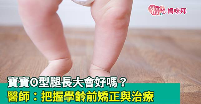 寶寶O型腿長大會好嗎？醫師：把握學齡前矯正與治療