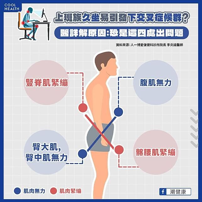 上班族腰痠背痛好不了  一檢查竟是「下交叉症候群」