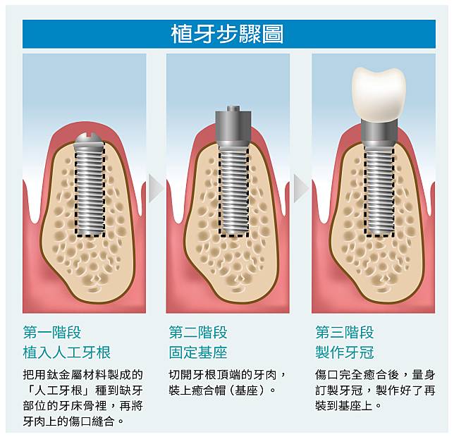 圖／全民健康基金會提供