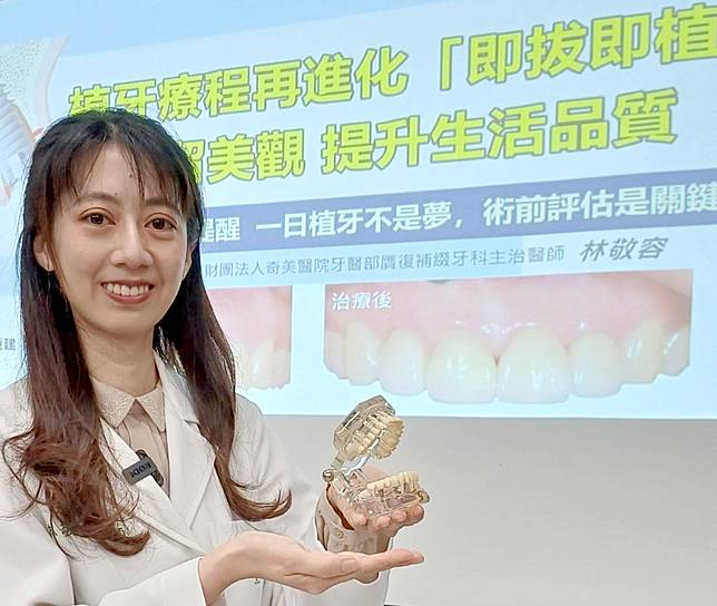 奇美牙醫部贋復補綴牙科主治醫師林敬容表示，植牙療程再進化，引進「即拔即植」技術為門齒斷裂等患者進行重建治療，除保留美觀也提升生活品質。　（記者汪惠松攝）