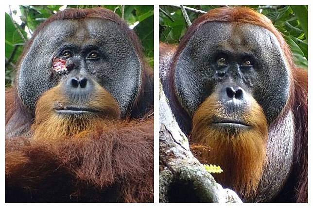 紅毛猩猩自製草藥治療臉部傷口，1個月後痊癒。美聯社