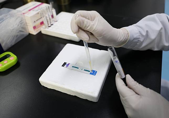 A doctor tests a sample for HIV/AIDS infection at the Fourth People's Hospital of Nanning, in Nanning, south China's Guangxi Zhuang Autonomous Region, Nov. 21, 2024. (Xinhua/Jin Haoyuan)