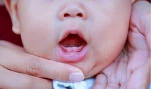 嬰兒長牙：原因、症狀、診斷、治療