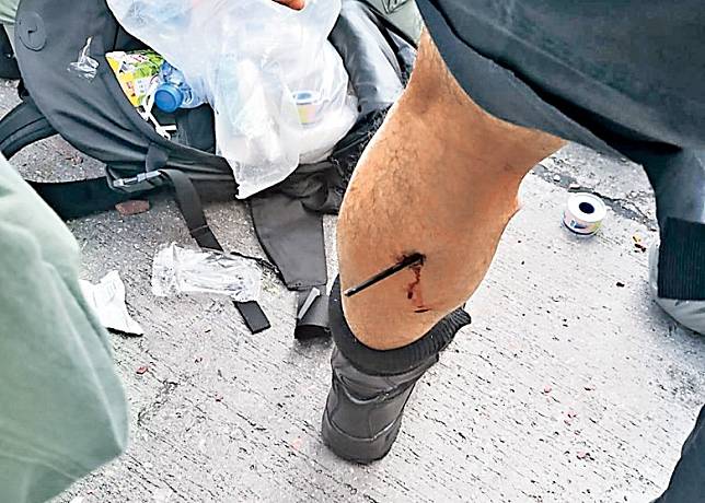 警方傳媒聯絡隊警員被暴徒用箭射傷腳部，活動能力恐受損。