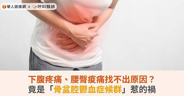 下腹疼痛、腰臀痠痛找不出原因？竟是「骨盆腔鬱血症候群」惹的禍