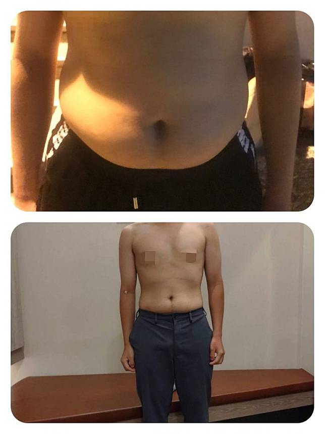 17歲的丁丁減重前（上）後（下）比較。（記者湯朝村翻攝）