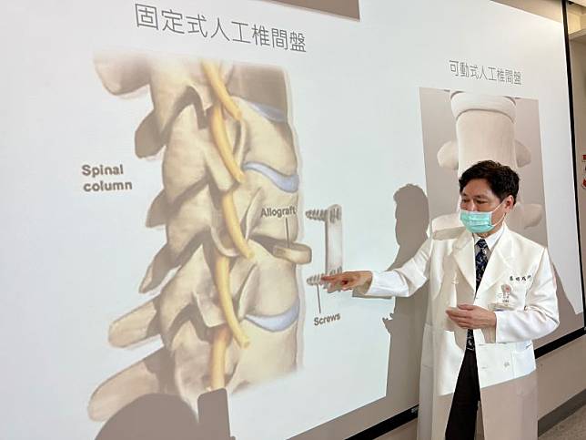 新光醫院神經外科 蔡明成主任。(圖／記者周淑萍攝)