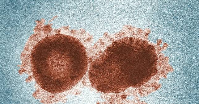 醫染「產志賀毒素大腸桿菌」4天過世　傳播途徑、症狀一次看