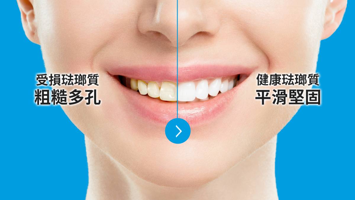 【情報快遞】亞洲人牙齒老得快？「2招」檢視琺瑯質