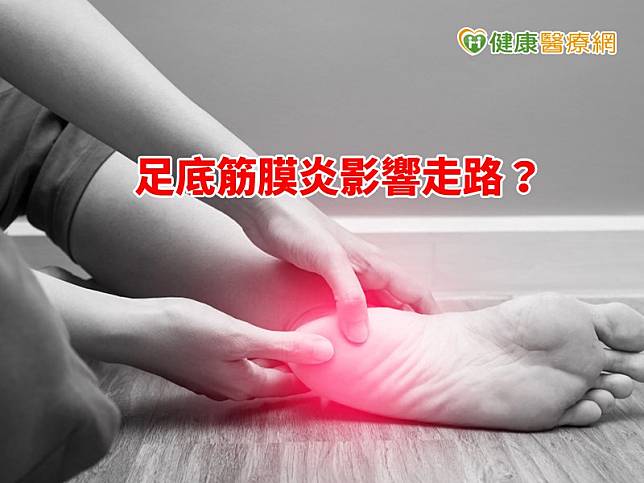 足底筋膜有如弓弦一般，當腳著地時，因為體重會迫使足弓張開，足底筋膜也如弓弦一樣拉長，若是有足底筋膜炎就會產生疼痛。