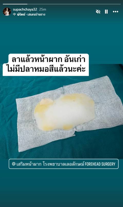 หนูรัตน์ ศัลยกรรมถอดหน้าผาก บอกลามีมปลาหมอสี