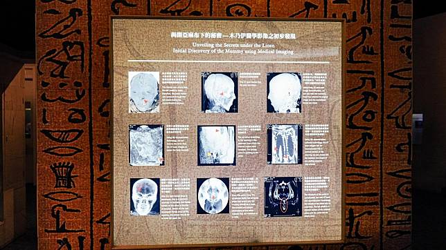 科博館臉書也附上木乃伊的X光照片，證明他是「真屍」。（翻攝自國立自然科學博物館 National Museum of Natural Science臉書）
