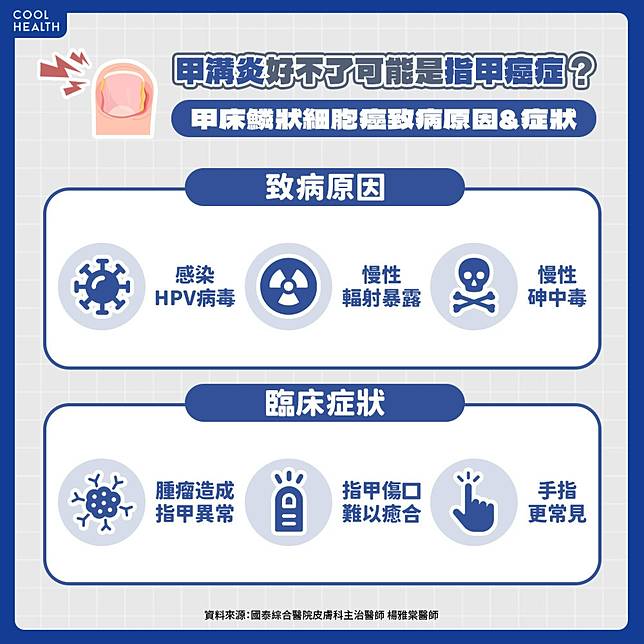 甲床鱗狀細胞癌的好發族群？ 致病原因與感染「這病毒」有關