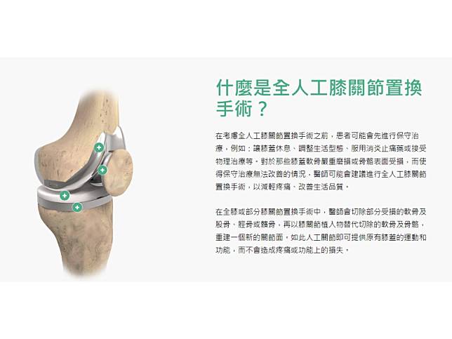 圖片截取自聯合骨科官網