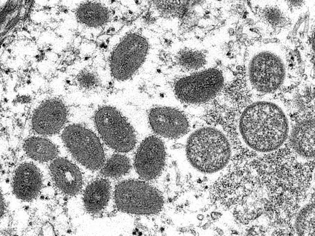 猴痘疫情蔓延 世衛第7度宣布全球公衛緊急事件