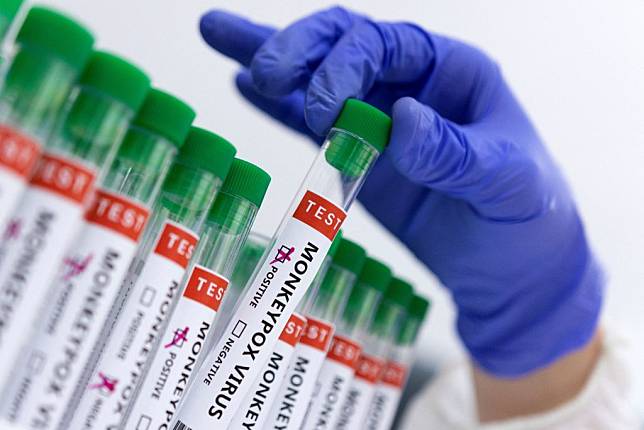 美國正準備對猴痘確診者的密切接觸者提供疫苗及治療。圖為「猴痘病毒陽性和陰性」的試管。 （路透）