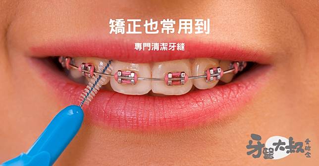 黃柏青醫師 授權提供