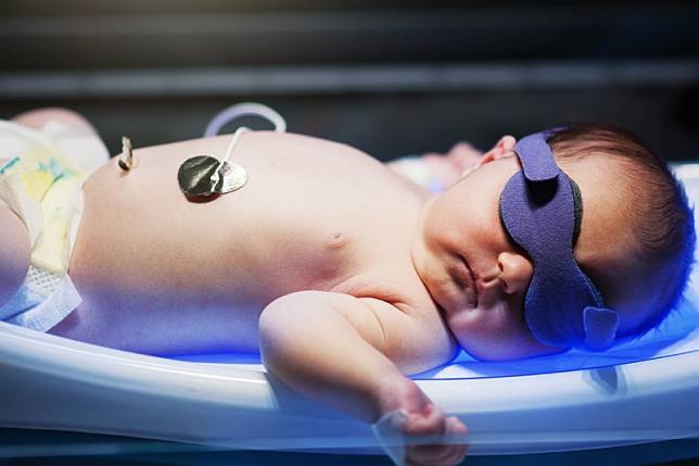 Newborn,Baby,Laying,On,Special,Bed,Uv,Phototherepy,For,Jaundice